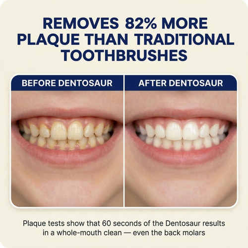 Dentosaur™ U-Shaped 360° Ultrasonic Toothbrush